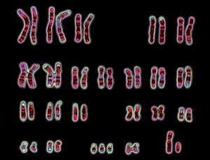 Protein dose reverses learning problems in Down's mice