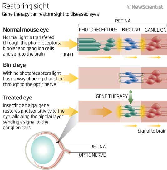 Restoring sight