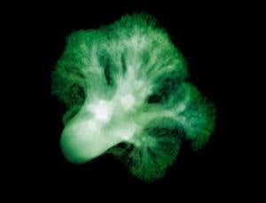 Broccoli helps clear damaged lungs