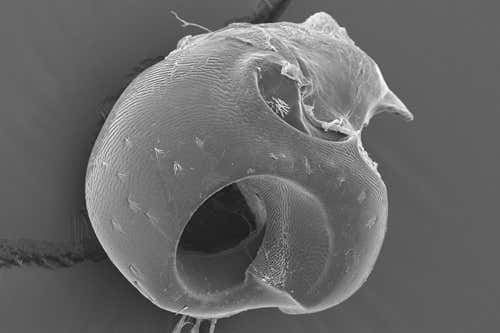 The opening in a weevil's coxa, into which the trochanter screws, with inner thread visible