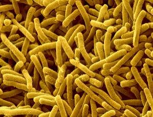 Not so simple: Bugs that hunt in packs