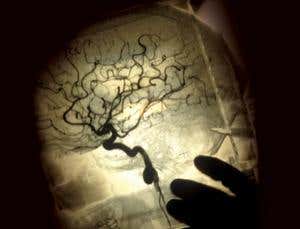 Intelligence: What is it?