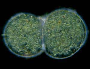 Not so simple: Bacteria with backbone