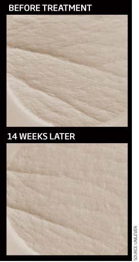 First anti-wrinkle pill shows signs of success