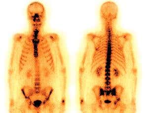 The atomic nucleus: Nuclear technology