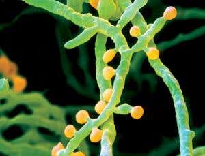 Killer fungi made us hot-blooded