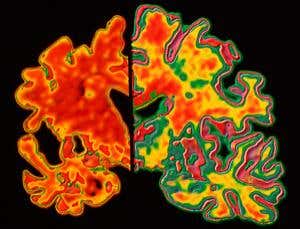 Memory: How to hold on to it