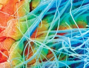 High-fat diet leaves its mark on sperm