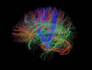 Smart Guide to 2012: Mapping the human brain