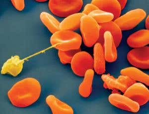 Gold nano 'ears' set to listen in on cells