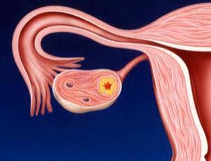 Ovarian stem cells discovered in humans