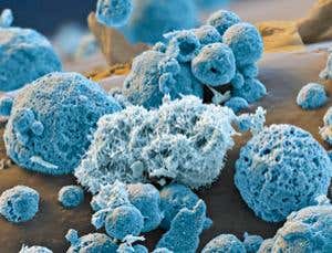 Blame dark matter underdog for mystery missing lithium