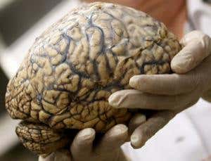 Puzzles of evolution: Why are our brains so big?