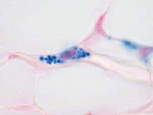 Iron-rich cells found in the pigeon beak. These cells, previously believed to be nerves are in fact macrophages, a type of immune cell. The bright blue stain shows balls of iron in the cell. Cell nuclei are shown in pink