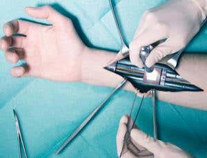 Gadgets work under your skin – but are you ready?