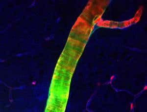 Waste disposal network discovered in the brain