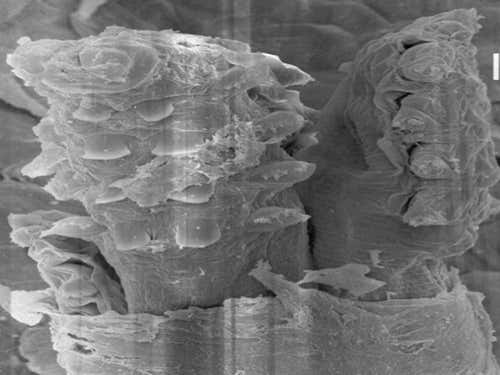 Demodex mite in the face of an adult