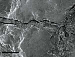 ancient filling in a tooth