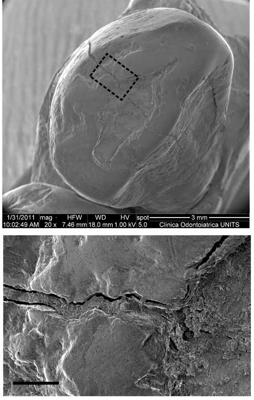 ancient filling in a tooth