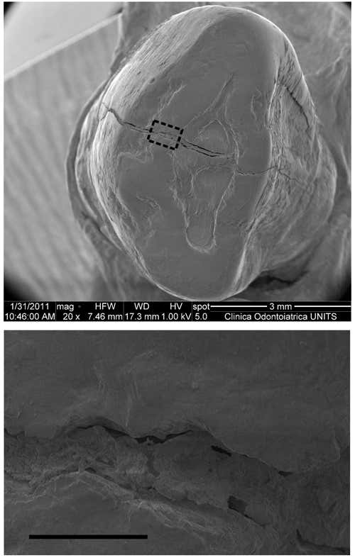 ancient dental filling