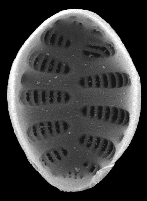 Staurosirella pinnata is one of the diatoms in Kaffeklubben 