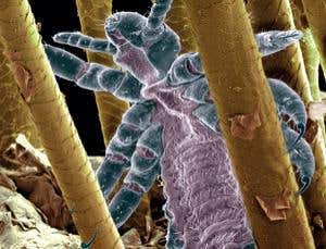 Of lice and men: A very intimate history