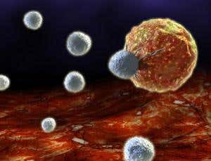 Souped-up immune cells force leukaemia into remission