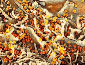 New Scientist. Science news and long reads from expert journalists, covering developments in science, technology, health and the environment on the website and the magazine.