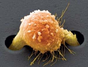 Physics not biology may be key to beating cancer