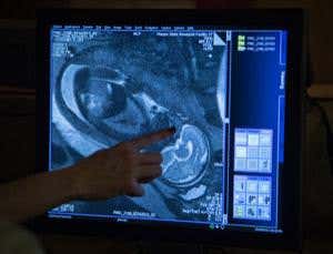 First snaps made of fetal brains wiring themselves up