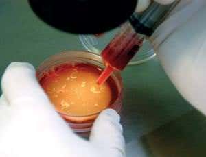 IVF sperm do better in a diamond dish