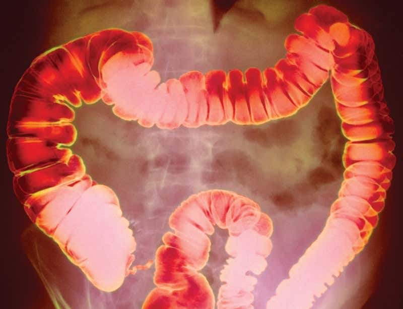 New Scientist. Science news and long reads from expert journalists, covering developments in science, technology, health and the environment on the website and the magazine.