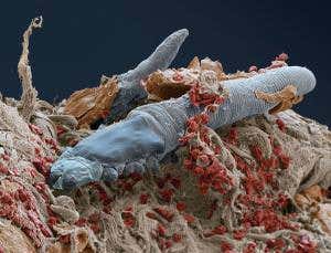 The body: The great skin safari