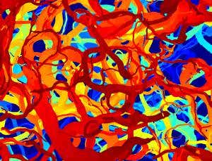 Hunting pack of bacteria paints a tangled skein