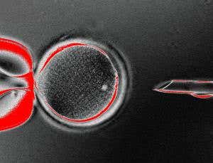 Cloned stem-cell study under fire for sloppy errors