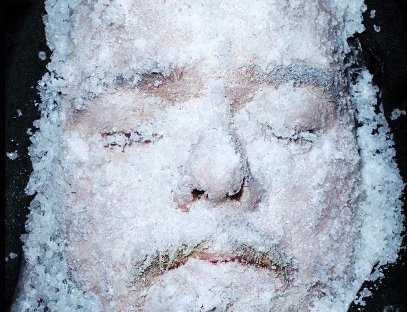 man with ice on his face