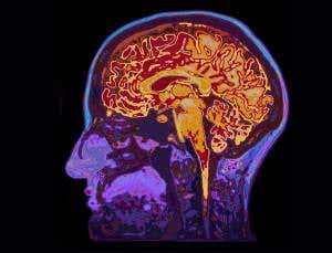 Consciousness: Watching your mind in action