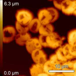Ötzi the iceman's cells show battle brain damage