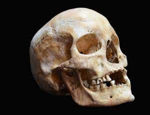 Medieval bones yield 1000-year-old leprosy genome