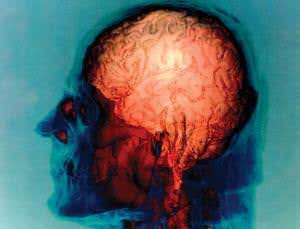 The trouble with neuroscience