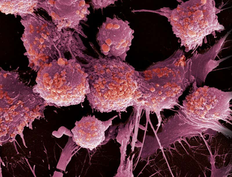 New Scientist. Science news and long reads from expert journalists, covering developments in science, technology, health and the environment on the website and the magazine.