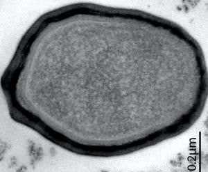 My so-called viral life: is discovery new life form?