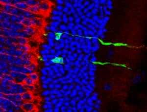 Eye receptor transplant promises therapy for blindness