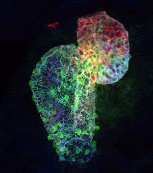 Heart, heal thyself! No problem, says the zebrafish