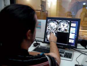 Why cancer protects from Alzheimer's and vice versa