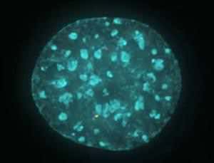 First images of DNA mix-ups linked to cancer