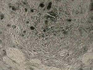 Mouse heart beats again thanks to human stem cells