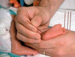 Should babies have their genomes sequenced at birth?