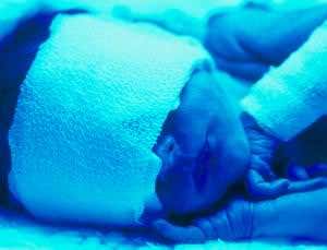 Portable jaundice therapy could save infants' lives