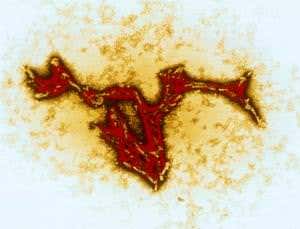 1 in 2000 Britons may carry 'mad cow' prion protein